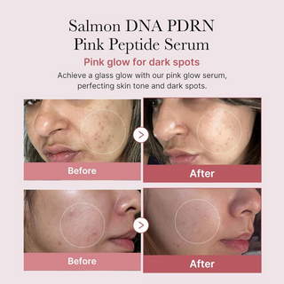PDRN Pink Peptide Serum