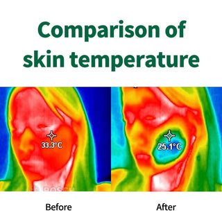 Comparison of skin texture with Dr. G's R.E.D Blemish Clear Soothing Cream shows a decrease from 33.3°C before use to 25.1°C after application.
