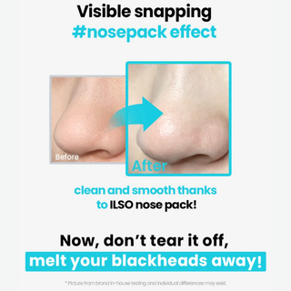 Natural Mild Clear Nose Pack Blackhead Remover Patch