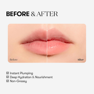 Reedle Shot Lip Plumper Beginner