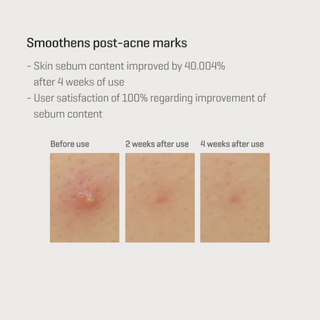 Retinol Intense Reactivating Serum