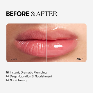 Reedle Shot Lip Plumper Expert