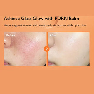 PDRN Enriched Recovery Balm