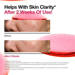 Niacinamide 10% + TXA 4% Dark Spot Correcting Serum