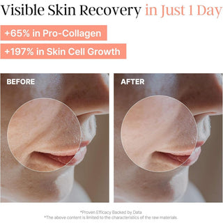 PeachMicrobiome 78 PDRN Toner