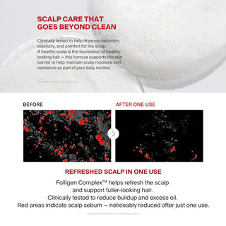 Folligen Original Hair Loss Shampoo