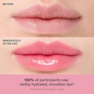 Lip Treatment