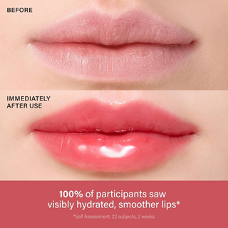 Lip Treatment