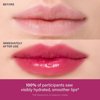 Lip Treatment