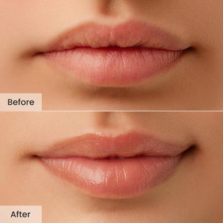 Propolis Lipcerin Lip Treatment