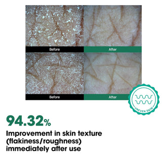 AHA BHA PHA Miracle Body Toner Mist