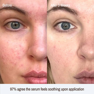Renew Barrier Boosting Serum