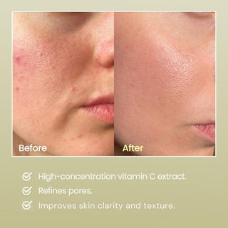 Real Vitamin C Serum