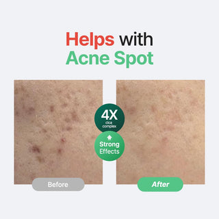 Wonder Releaf Centella Serum Unscented