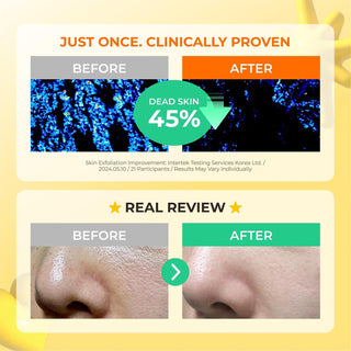 Watery Sulfur Pad (4 Week Solution)