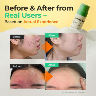 Watery Sulfur Pore Cleansing Powder